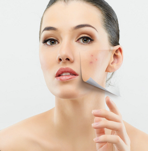 Micro Peel for Skin Care